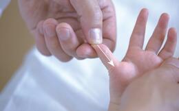 小儿打嗝停不下来,教你推拿手法和食疗秘方巧止呃