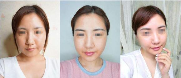 更年期月经不来怎样调理,更年期月经不来了该怎么办