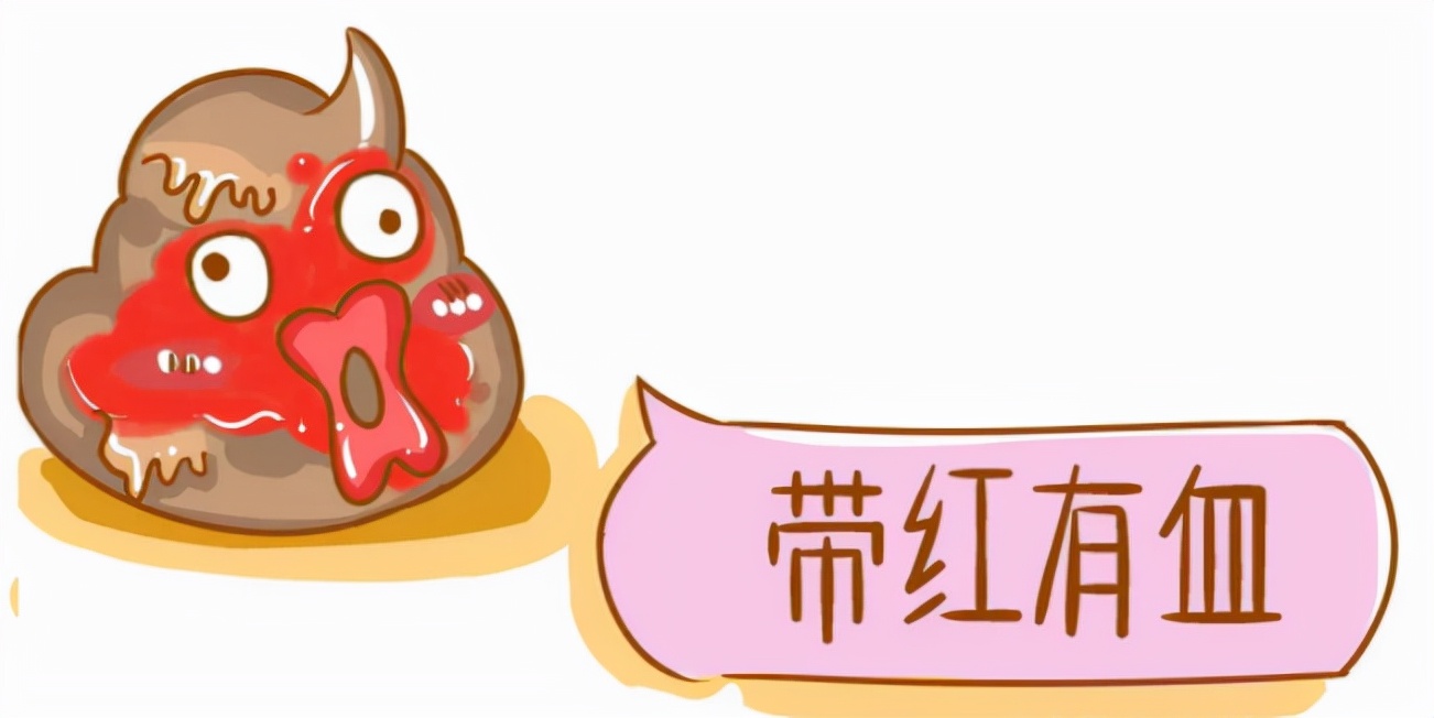 肛门息肉和痔疮症状有什么区别,长痔疮肛门狭窄有息肉该怎么治疗