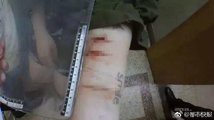 警惕！孩子私用锡箔纸、不锈钢的“笑气”包装瓶一定要注意！