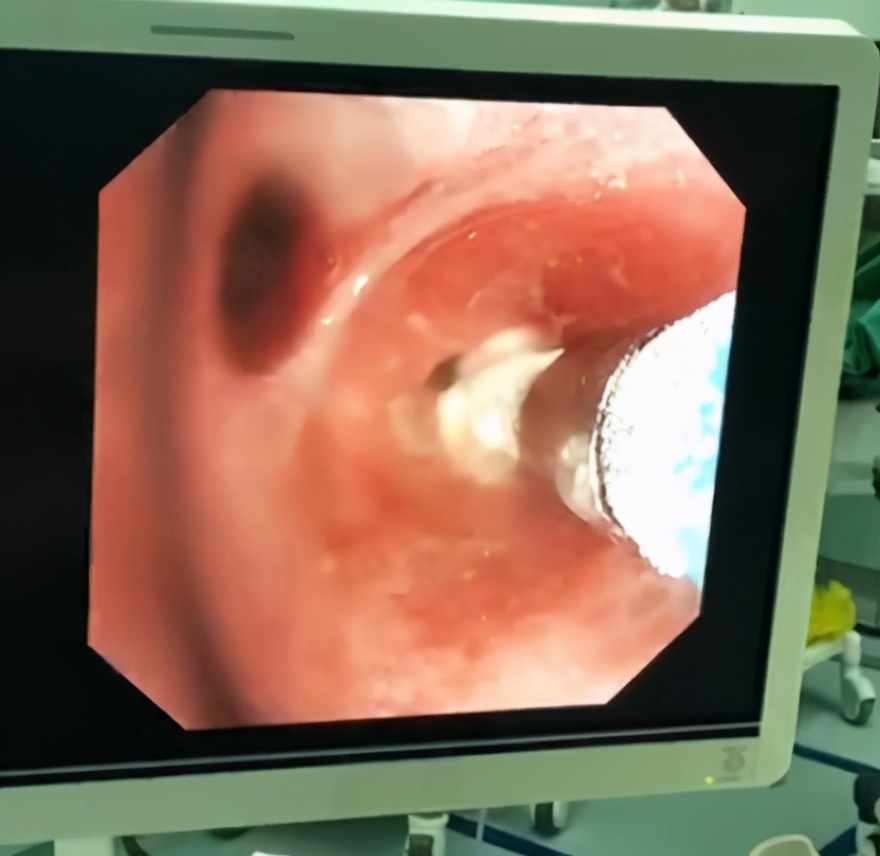 呼吸与危重症医学科,呼吸与危重症医学科主治医师