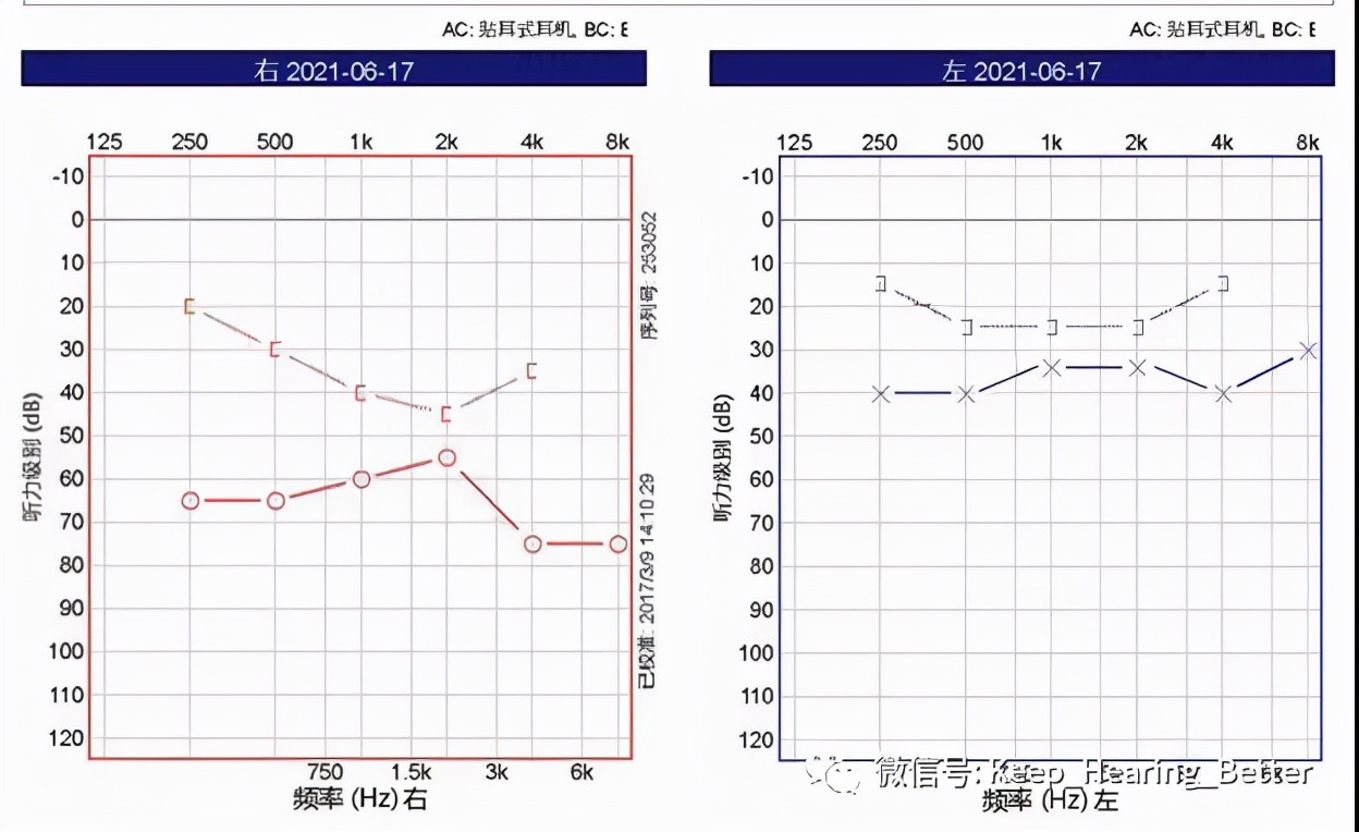 南大二附院,南大二附院耳鼻喉科专家