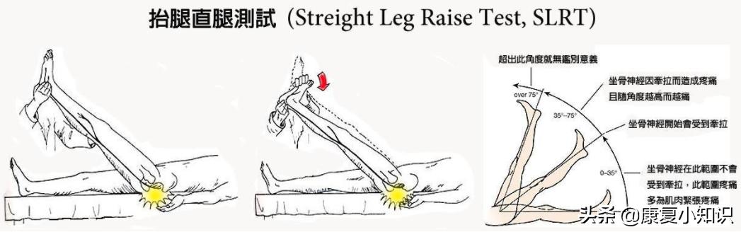 大腿后侧疼痛是癌症吗,大腿后侧疼痛有什么方法缓解