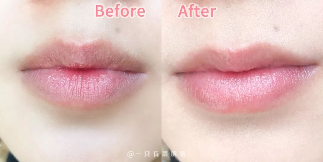 空管润唇膏,润唇膏空管