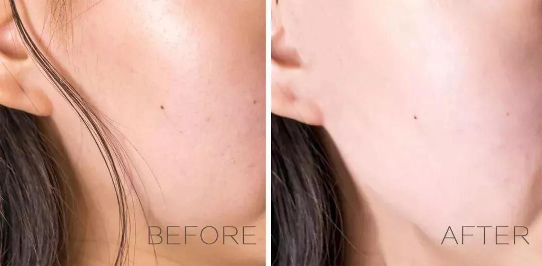 美白神器告别黄皮肤测评,黄黑皮专用美白神器