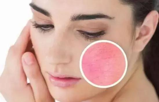 抗老修复护肤产品,修复类的护肤品有哪些品牌