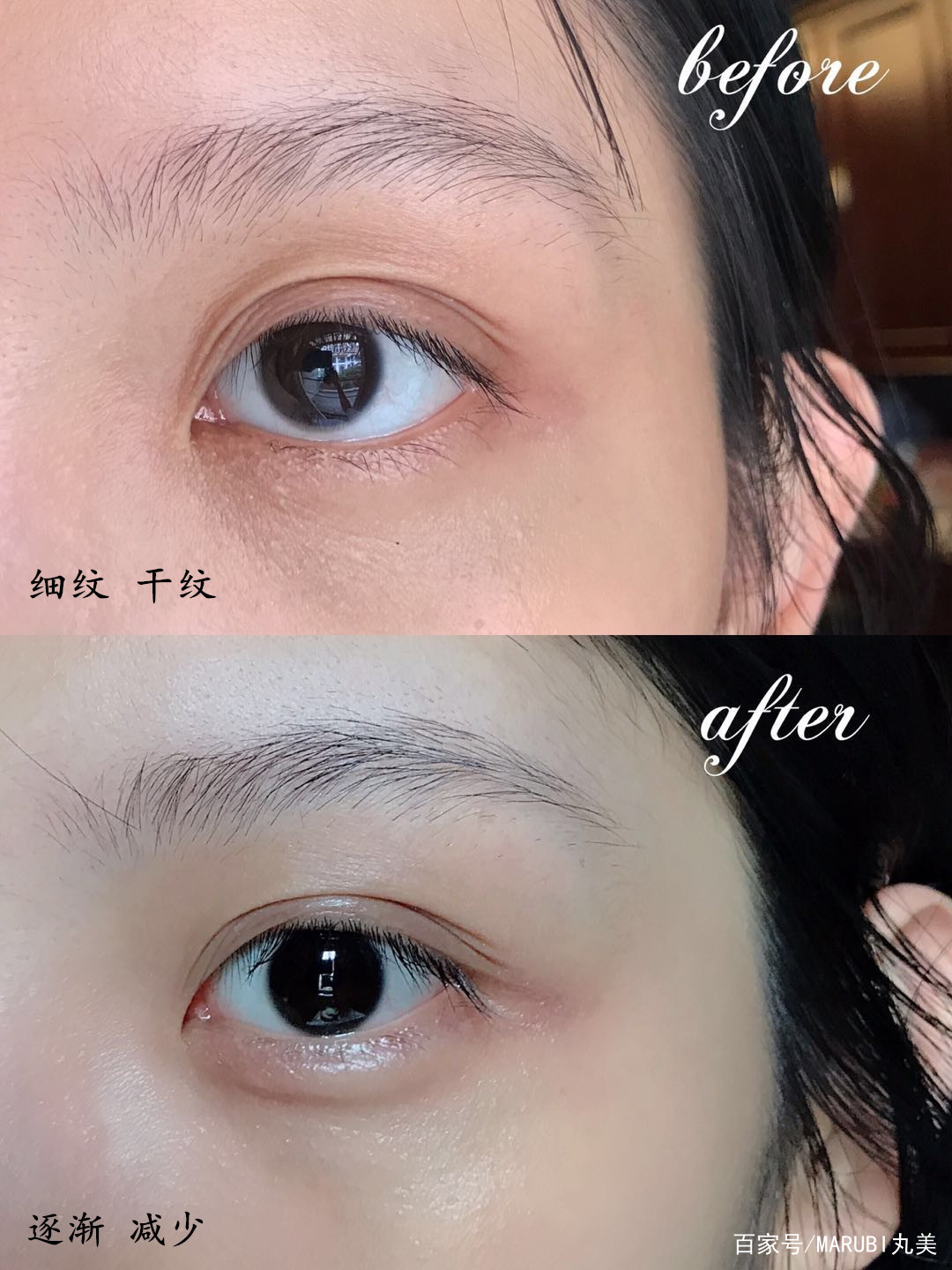 淡化眼纹的误区,眼部抗老干货淡化眼纹的按摩手法