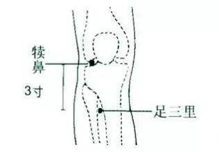 点刺穴位大全,局部针刺法