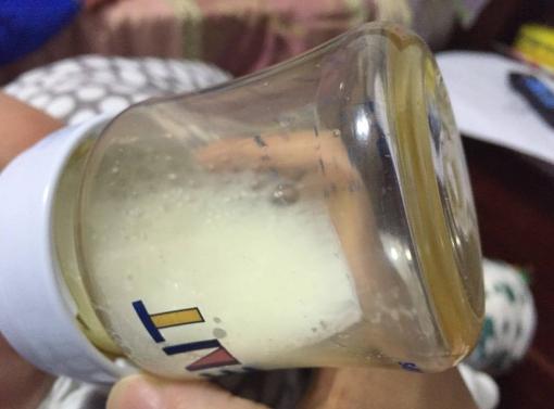 一岁宝宝视力不好有必要吃dha吗,dha为什么有助于宝宝视力发育