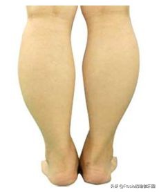 小腿粗壮最快的方法,小腿粗如何躺着瘦