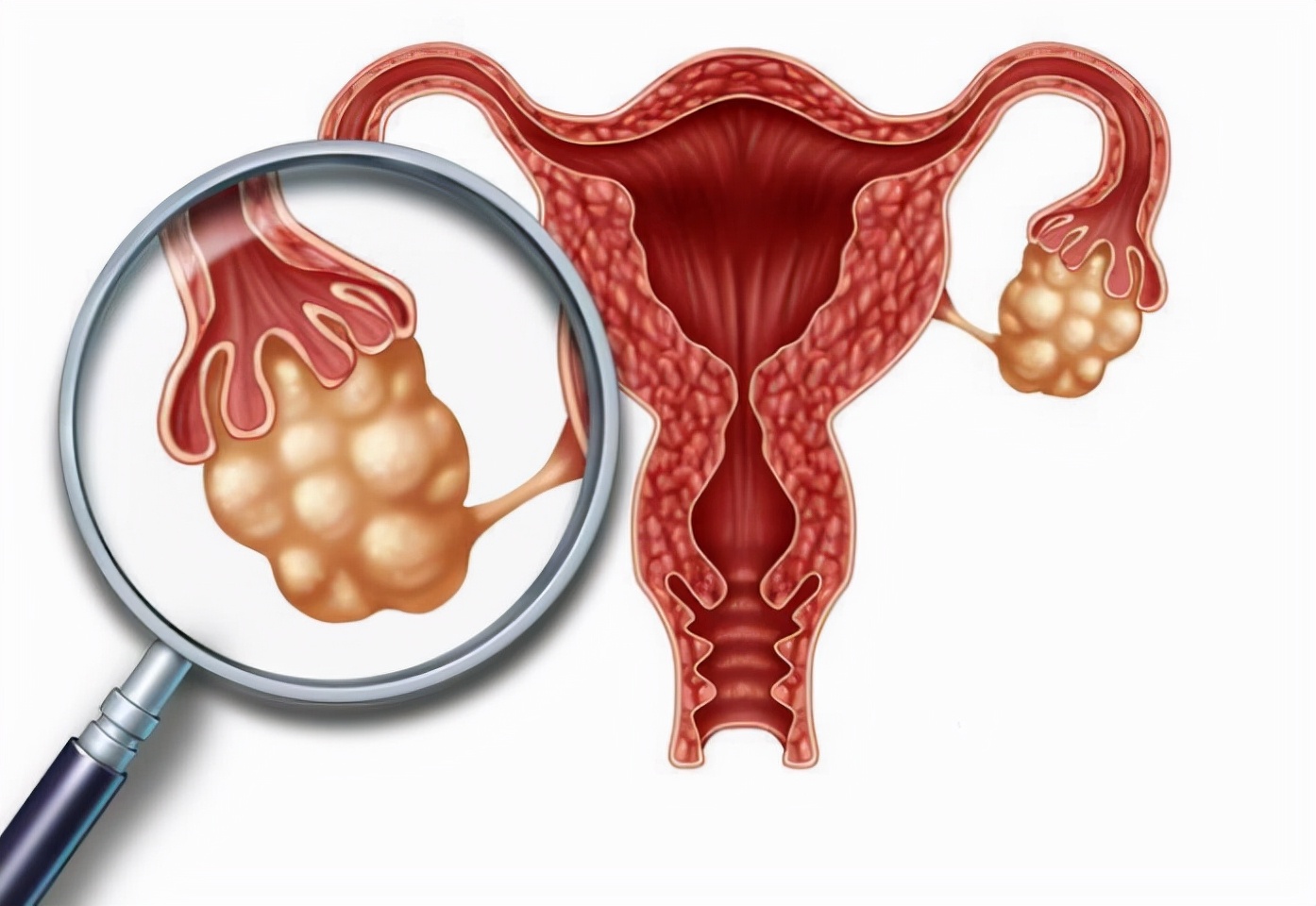 50岁女性想生二胎却遭遇卵巢癌，这真的是巧合吗