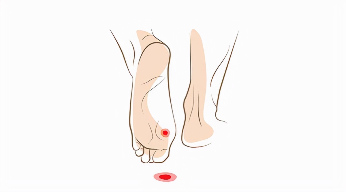 脚上长鸡眼了怎么才能去掉,脚上长鸡眼民间有什么说法