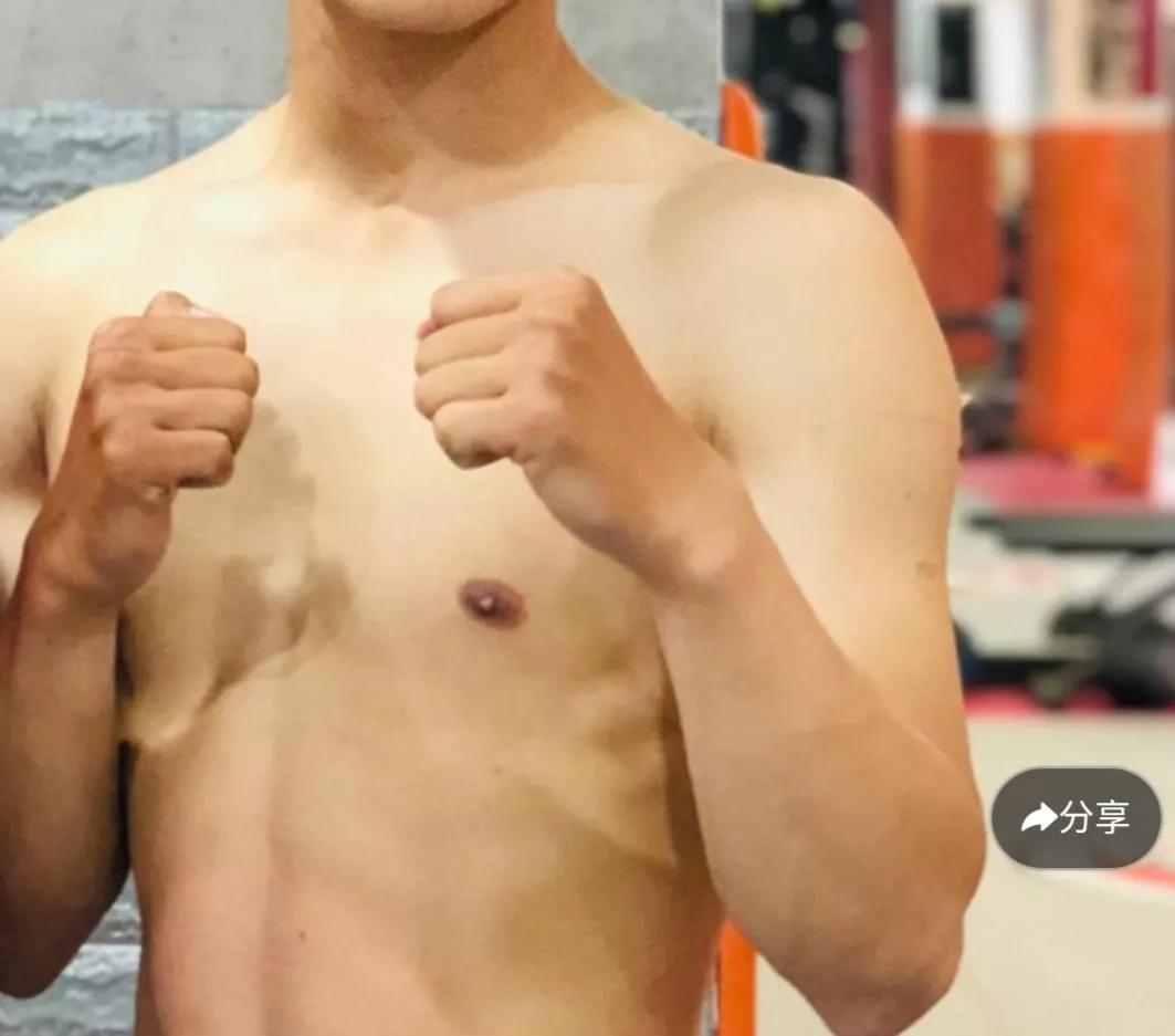 与鼻炎战斗的日子,鼻炎的真实生活日记