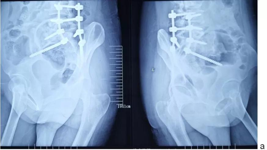 唐都医院脊柱科廖博,脊柱外科医生廖博