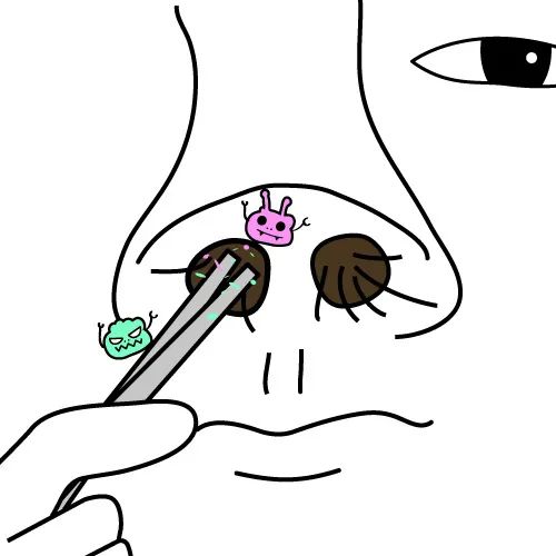 鼻毛被拔出来,鼻毛为什么轻轻一拔就掉了