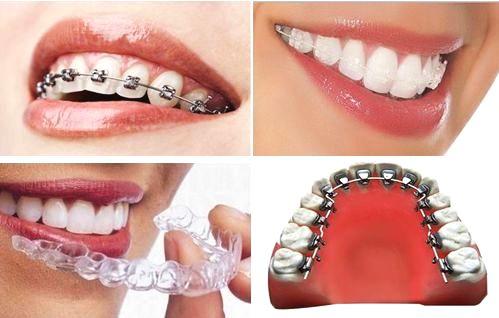 北大口腔专家科普正畸牙齿,大连齿医生口腔