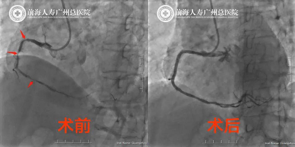 感谢医生医术精湛的锦旗,心血管科医生锦旗感谢词