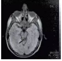 农场里走出CT鼻祖，美苏核危机诞生磁共振