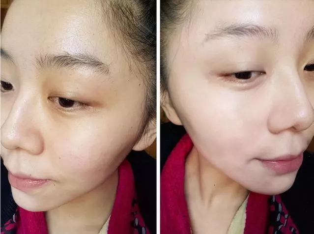 沈梦辰推荐祛痘好物,沈梦辰推荐的洗面奶有哪些