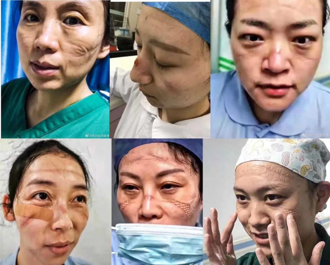 抗击肺炎医生累倒的图文,抗击肺炎医生们都累了