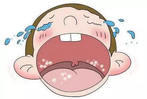 新生儿鹅口疮科普知识,新生儿鹅口疮是院内感染吗