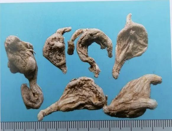 收敛止血的中成药有哪些,止血收敛的药有哪些