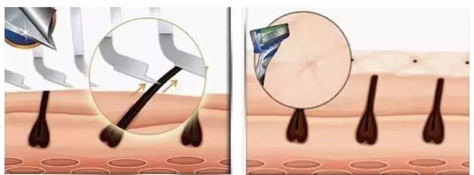 让吉列都抓狂的“手动剃须刀”，网友：最了解的男人还是小米有品