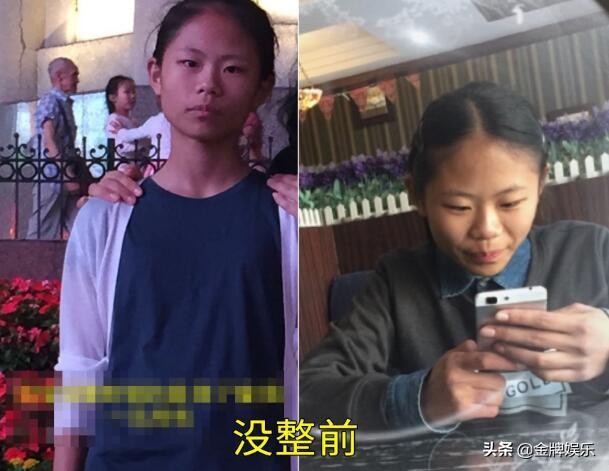 网红小娜娜整容了吗,小z娜娜整容过度的后果
