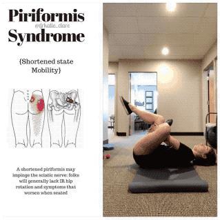 压到坐骨神经怎么缓解,坐骨神经痛吊单杠缓解