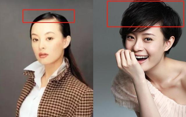 秃头大夫教你让头发浓密且多,秃头少女该如何挽救头发