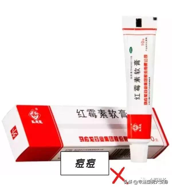 黑头粉刺药膏排行榜10强,推荐祛痘痘黑头药膏
