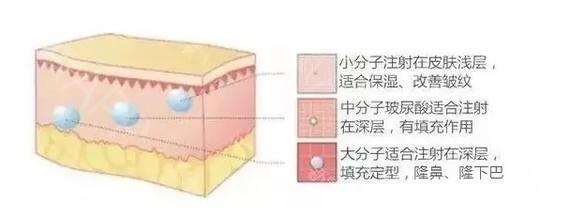 玻尿酸精华液可以用来敷面膜吗,酵母玻尿酸精华液的功效与作用