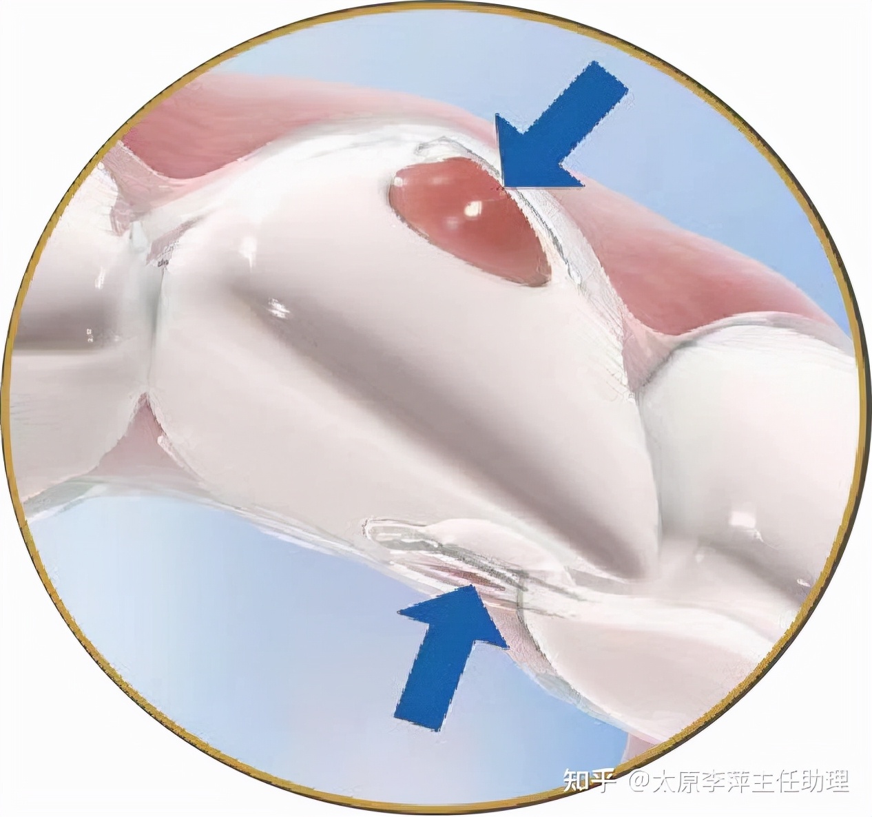 太原牙齿矫正靠谱吗,太原成人隐形牙套牙齿不齐