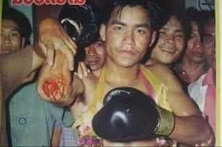 你这一胳膊肘下去,对方的头骨都可能会被干裂?硬核分析不容错过