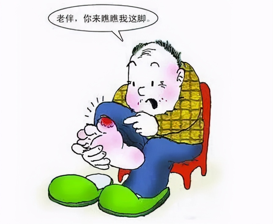 重视足部护理，50%的糖尿病足溃疡其实可以预防