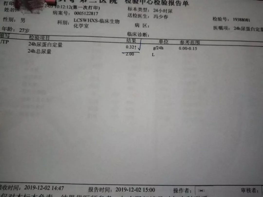 蛋白尿2+怎么预防,蛋白尿2+能用哪些中药治疗呢