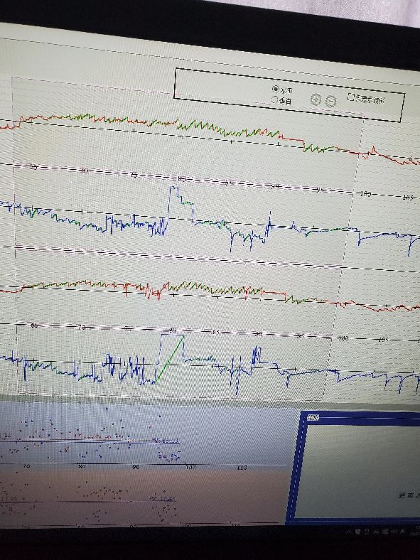 老年人颈椎病引起头晕恶心呕吐,头晕恶心干呕是不是颈椎病