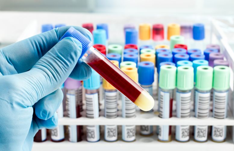 艾滋病亲吻会传染艾滋病吗,与艾滋病患者接吻会感染艾滋病吗