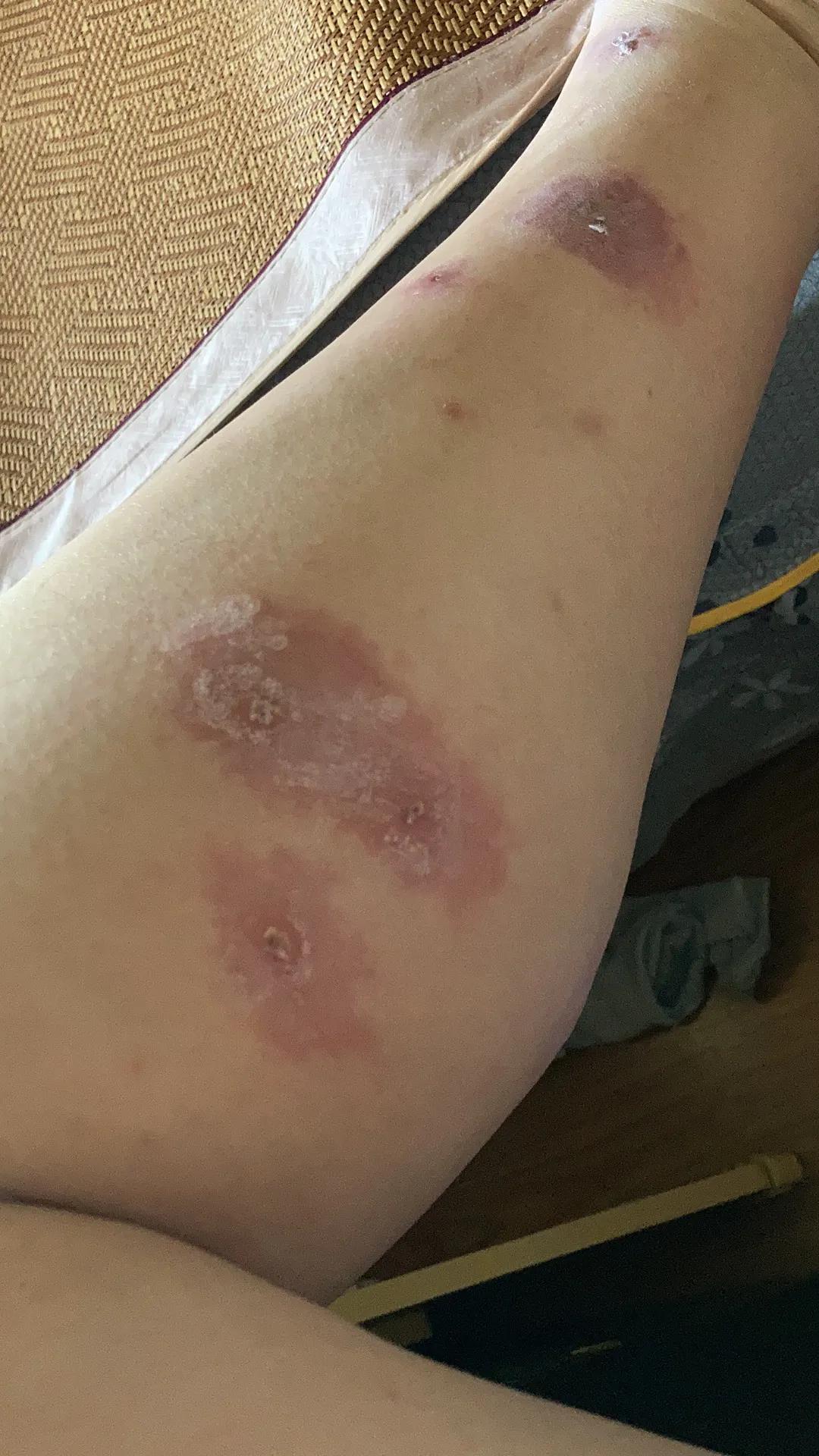 小咬蠓虫天敌,小咬蠓虫照片