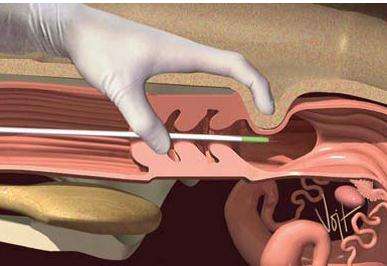 奶牛繁育与人工授精百科,奶牛人工授精动画流程