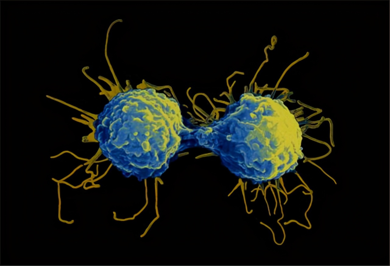 怎么区分咽炎和喉癌,怎么区分咽炎和下咽癌