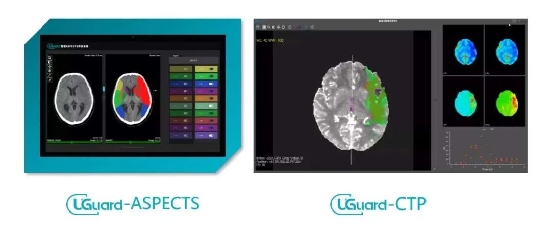 治疗脑梗死输什么液体最好,亚急性脑梗死怎么治疗最好