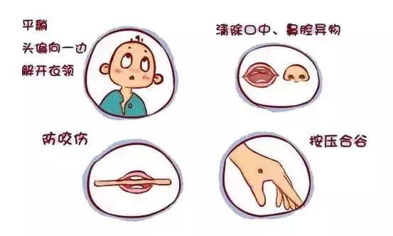 宝宝高热惊厥急救知识科普,宝宝高热惊厥家长如何正确应对