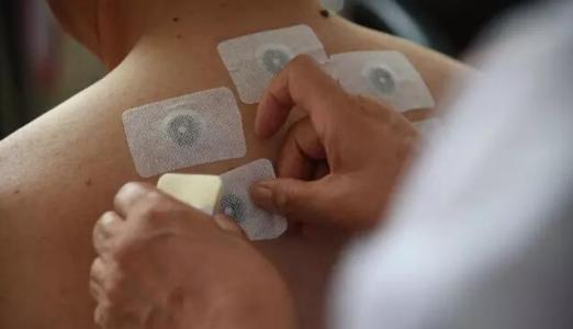 冬病夏治三伏贴都治哪些病,冬病夏治三伏贴好处宣传图片