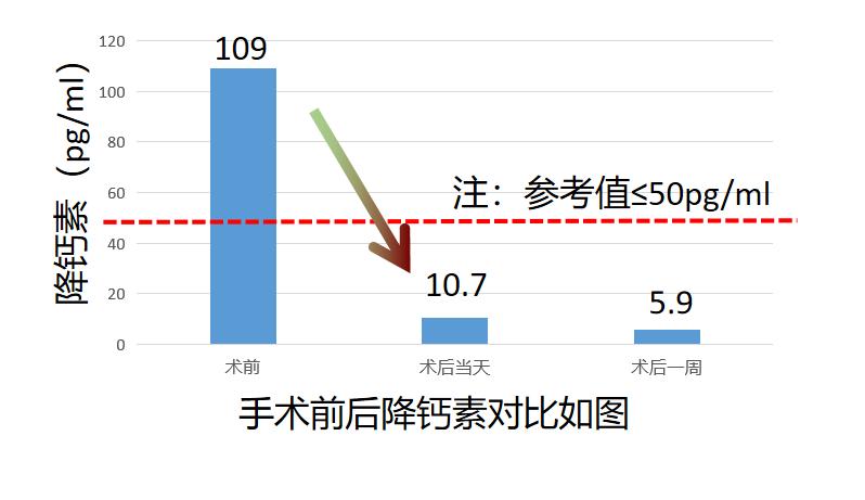 甲状腺癌是不是懒癌,甲状腺癌会感觉特别懒不想动吗