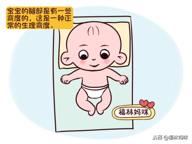 新生儿需要包裹绑腿防止罗圈腿吗,罗圈腿18岁可以绑腿矫正过来吗