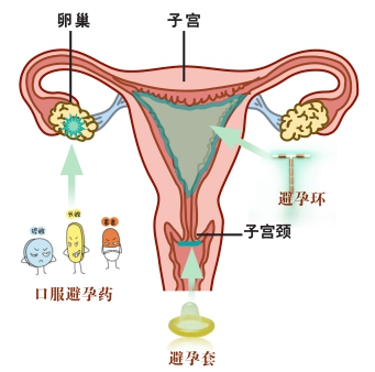 男女青年结婚前、特殊的围婚“孕”期