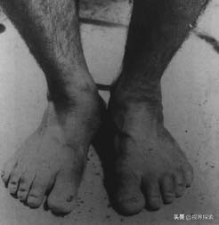 你的胎记在哪个位置看出你的含义,你的胎记在哪里找