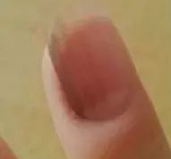 指甲有四种现象很危险,指甲反映身体状况