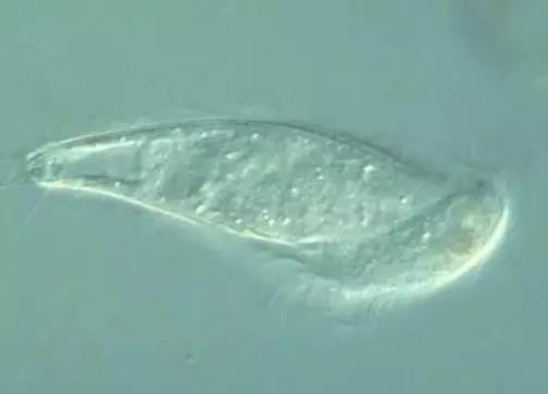 污泥镜检操作方法,污泥检测项目及标准有哪些呢